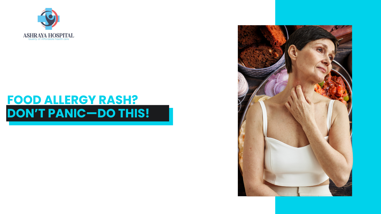 Food Allergy Rash